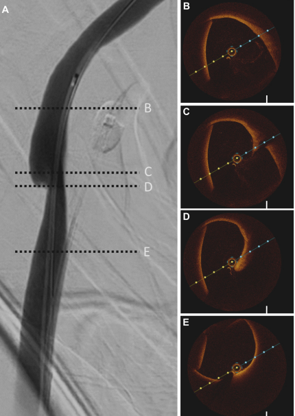 Transcatheter Neurosurgical Technologies Lab tweet media