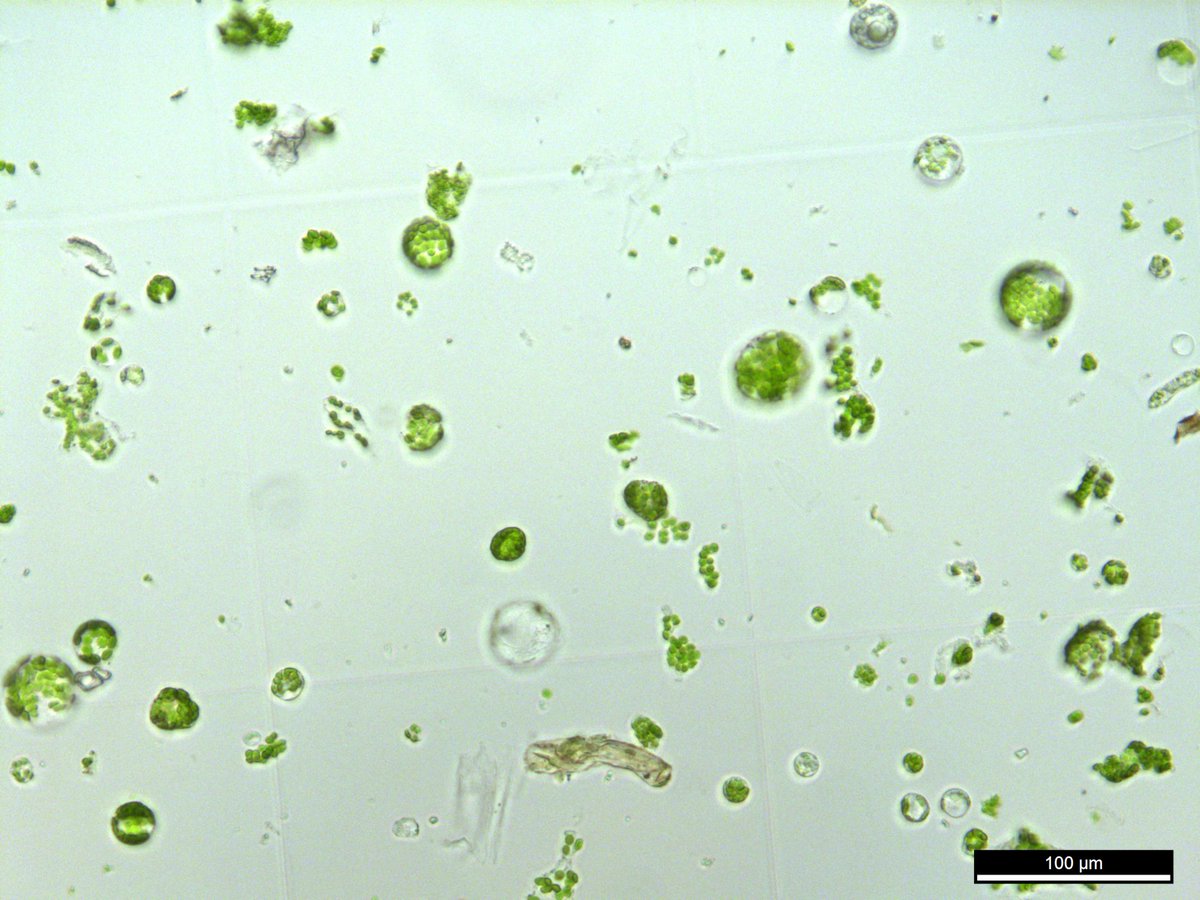 DFG_ICIPS's tweet photo. On the way to C-fern sporophyte protoplasting.... cell walls removed via enzymatic digestions but optimization required to keep the protoplasts surviving for some longer!!
📸Julian Garrecht #DFG_ICIPS https://t.co/VGIE5XDMR5
