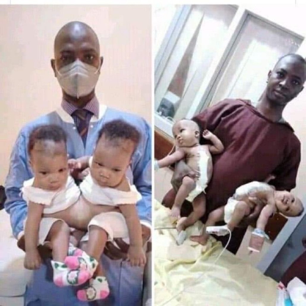 InsideIlorin_NG's tweet image. A team of Nigerian Based Doctors Successfully Separated Conjoined Twins at the University Of Ilorin Teaching Hospital Kwara State, Nigeria.

Let's celebrate our wins; this is a success to be proud of!

Pls, Retweet and follow @Insideilorin_NG

Source: @NigeriaStories