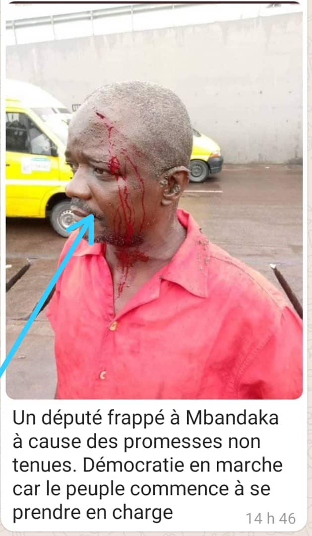 PierreYula's tweet photo. Fatiguée de la souffrance lui imposée par les autorités provinciales, la population de Mbandaka se prend en charge en instaurant l’opération beta député, beta Ministre provincial. Les premières victimes se comptent déjà https://t.co/taqvzT65bD