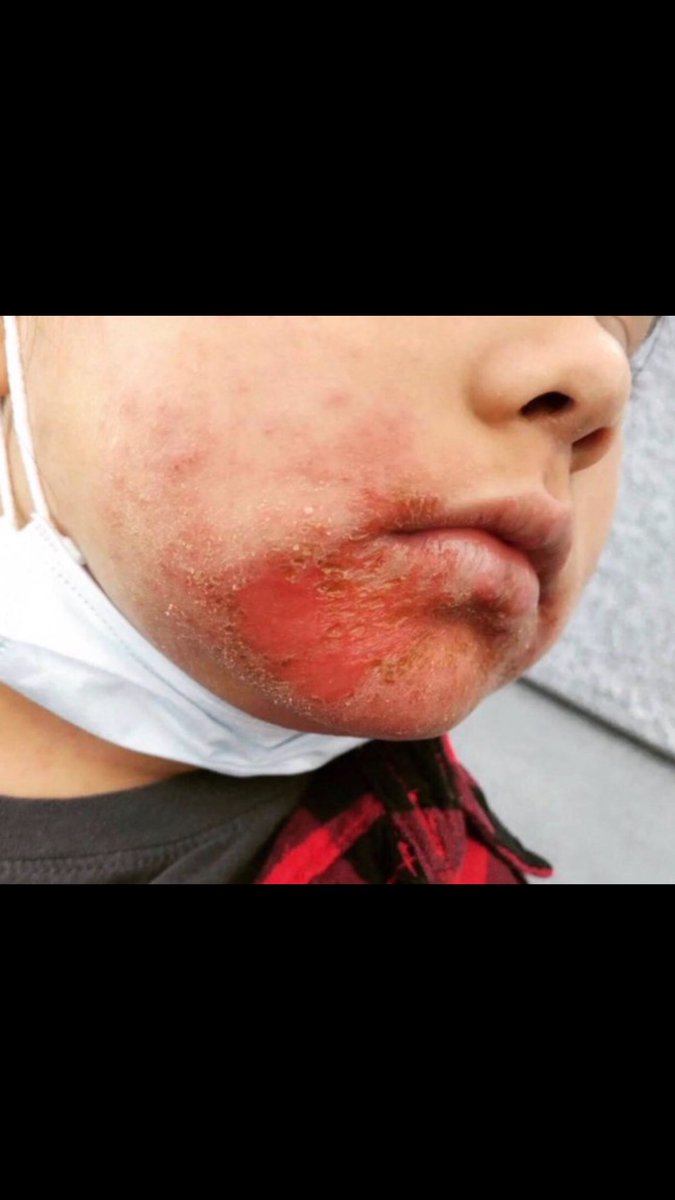 9blanc0's tweet photo. M/\$K$ = Child Abuse #maskswork #Masks #maskskill #Masks4Equity https://t.co/iHSO3Ylj8t