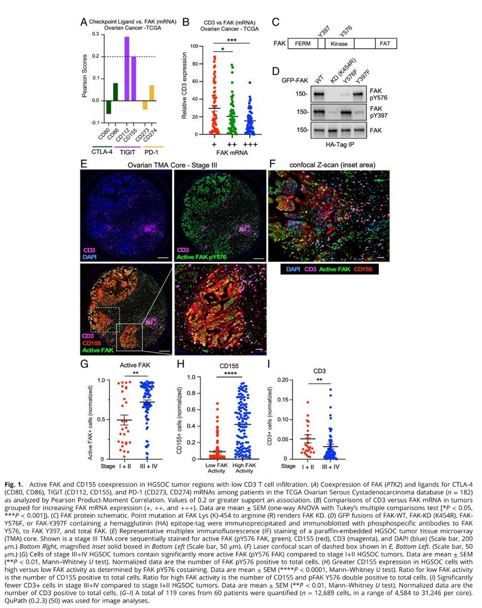 CrozrX's tweet photo. Last year, @DrNadiaChaudhri story touched, inspired many! And raised awareness about #HGSOC High Grade Serous Ovarian #cancer! Hope, research like this leads to effective, safe, lasting therapeutic options! #FAKi #TIGIT #CD155 
https://t.co/63JRGEPzql https://t.co/B7PPJ6IiUD