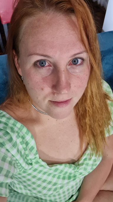 what about my eye? https://t.co/xivGSShTyh<a href="/tag/life"class="tags"><span>#life</span></a><a href="/tag/curvy"class="tags"><span>#curvy</span></a><a href="/tag/mom"class="tags"><span>#mom</span></a><a href="/tag/redhair"class="tags"><span>#redhair</span></a><a href="/tag/redhairedgirl"class="tags"><span>#redhairedgirl</span></a>