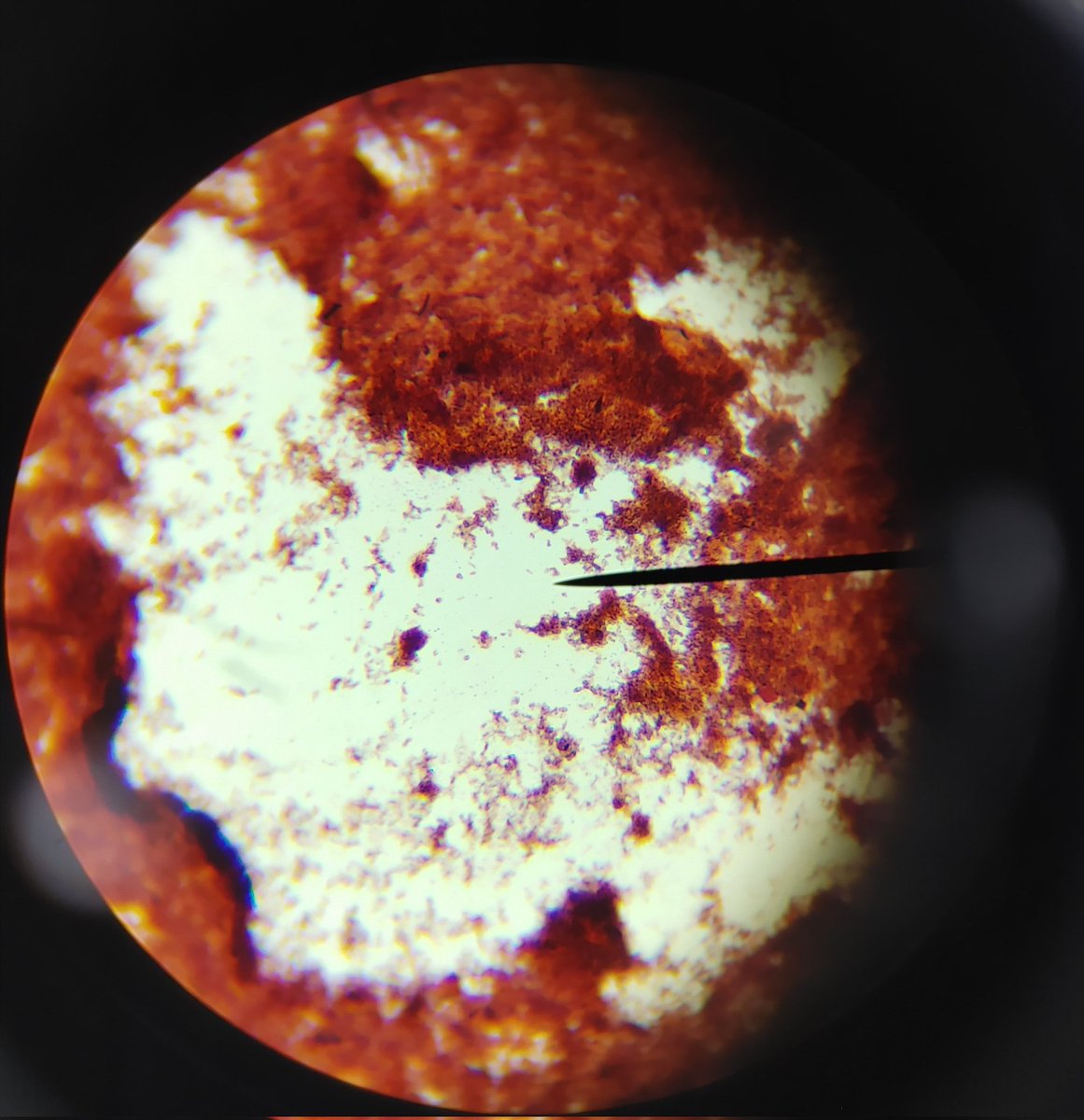 MLHSCook's tweet photo. Micro kids learned about gram staining today! Pretty good for their first time😉 #CTE #microbiology #Biomed #futurehealthprofessionals #AllInAtEast https://t.co/kuhXLWZN8C