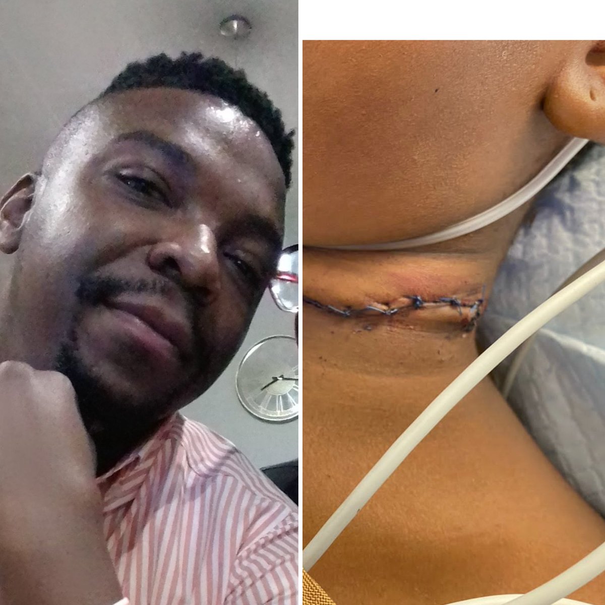 phetoloseroka's tweet photo. Thank you everyone for your support, this cruel man sliced my 9year old niece with a knife on the neck, handed himself in at hammanskraal police station, all we need now is the justice for my niece who is still in hospital recovering, please retweet 🙏 Mihlali, #bbmzansi https://t.co/2cSi6fUnrg