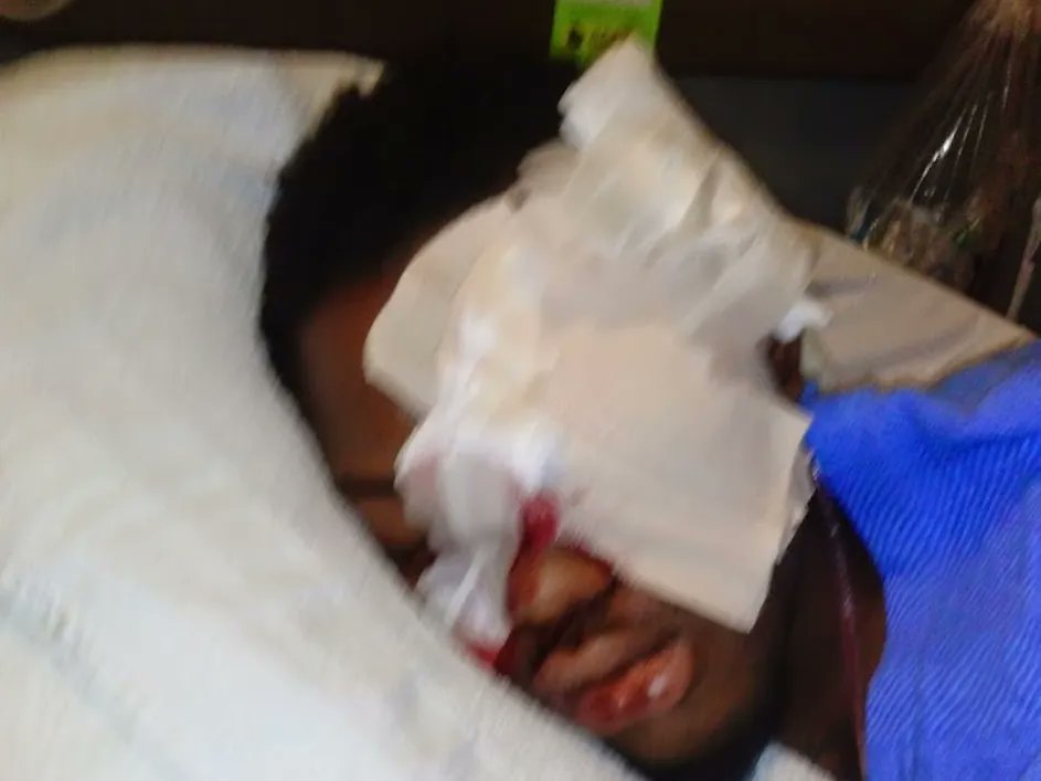 rechpauline's tweet photo. Percy diagnosed as child w/lead poison sent to #prison, got no medical care diagnosed w/incurable eye cancer-eye removed. His Mom 2 distraught 2 B present.#DOJ investigate #MDOC #allfacilities #paroleboard #poofficers #helpinthehouse #Solutionist #iamaningredient #JusticeGeneral https://t.co/a0t5yk8EcB