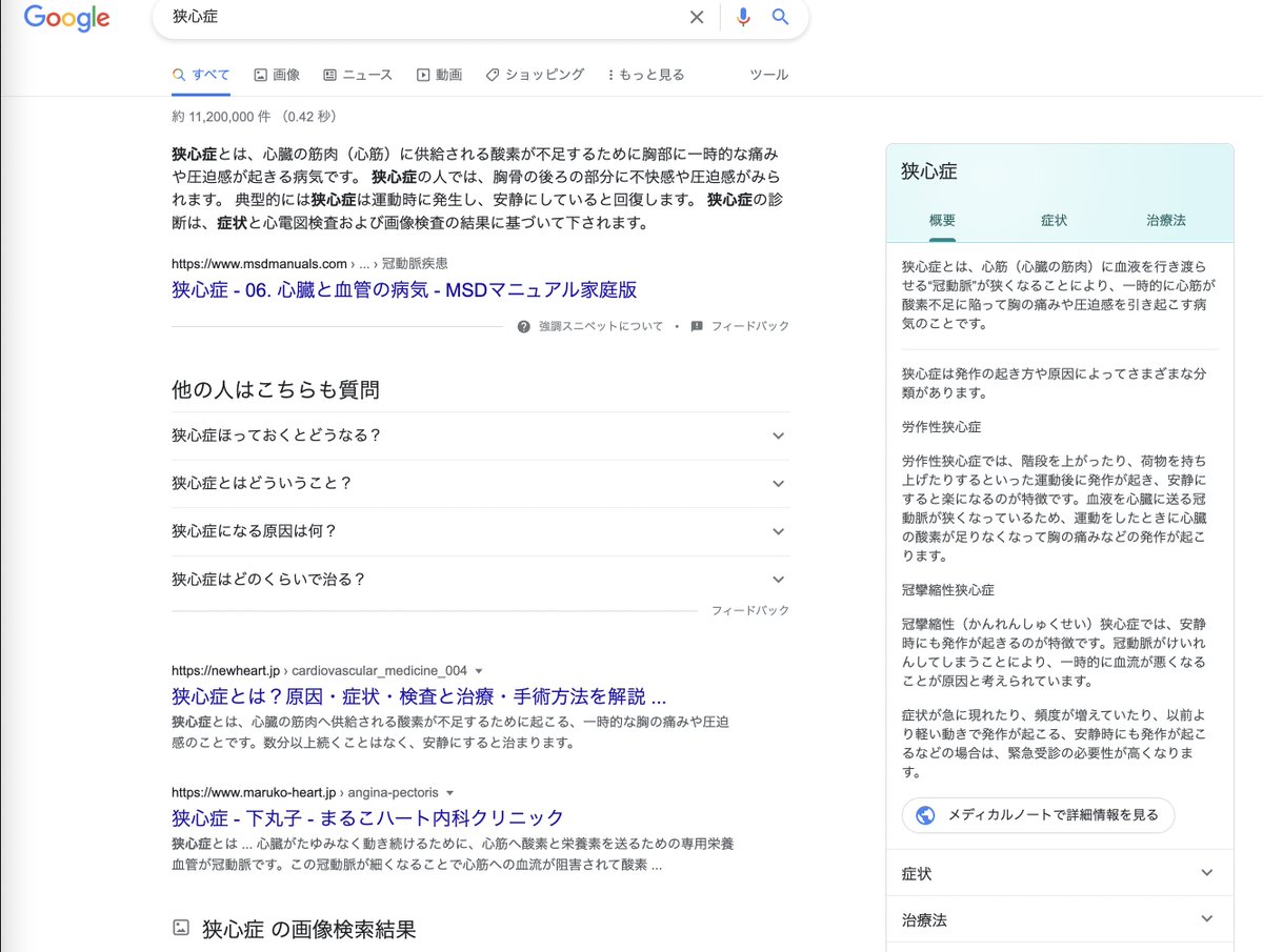 J_Circ_Assoc's tweet image. 試しに循環器病でGoogle検索したら出てきました。
すごい。
しかも #心不全 のページは我らが岸先生@tkishi_cardiolの監修ですよ😎😎
medicalnote.jp/diseases/%E5%B…

#MedicalNote
#メディカルノート