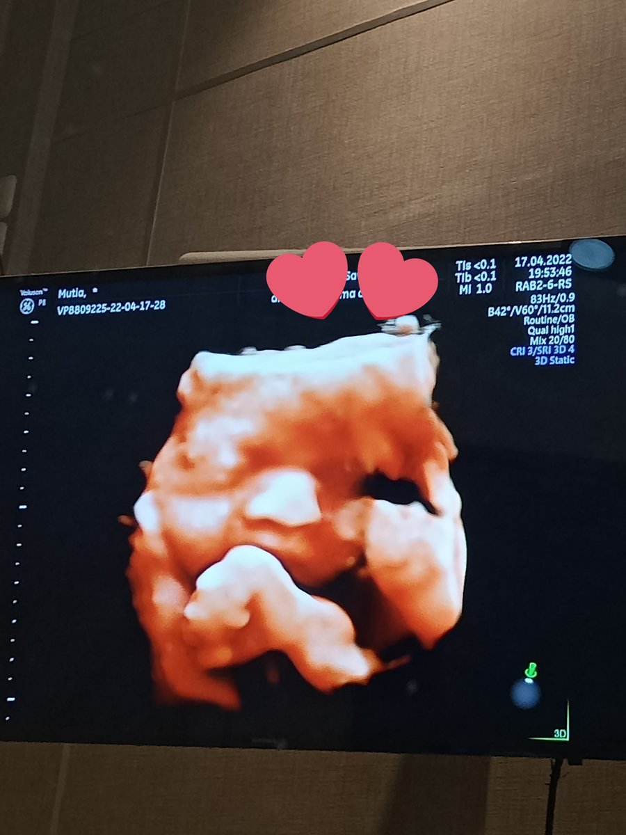 My baby angel❤️👶🏻