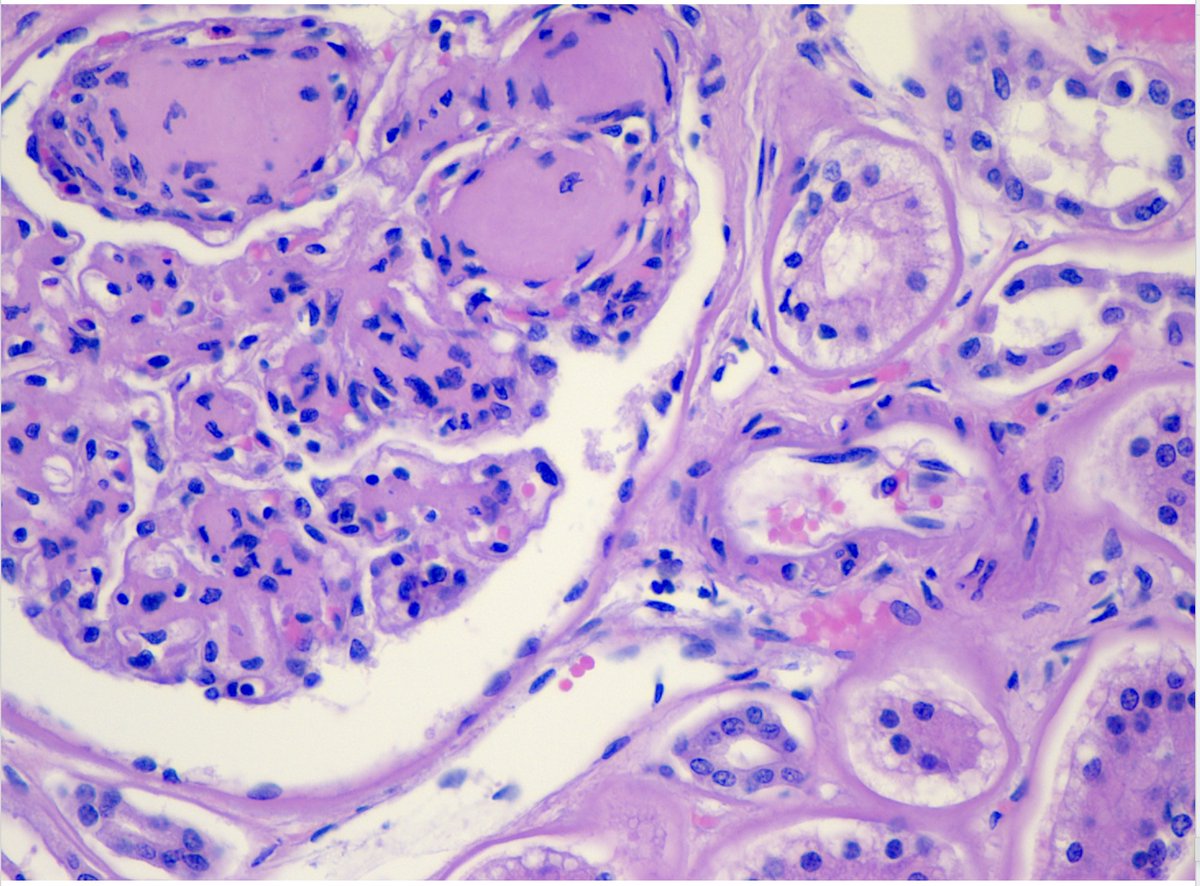 Willy Kemp tweet media