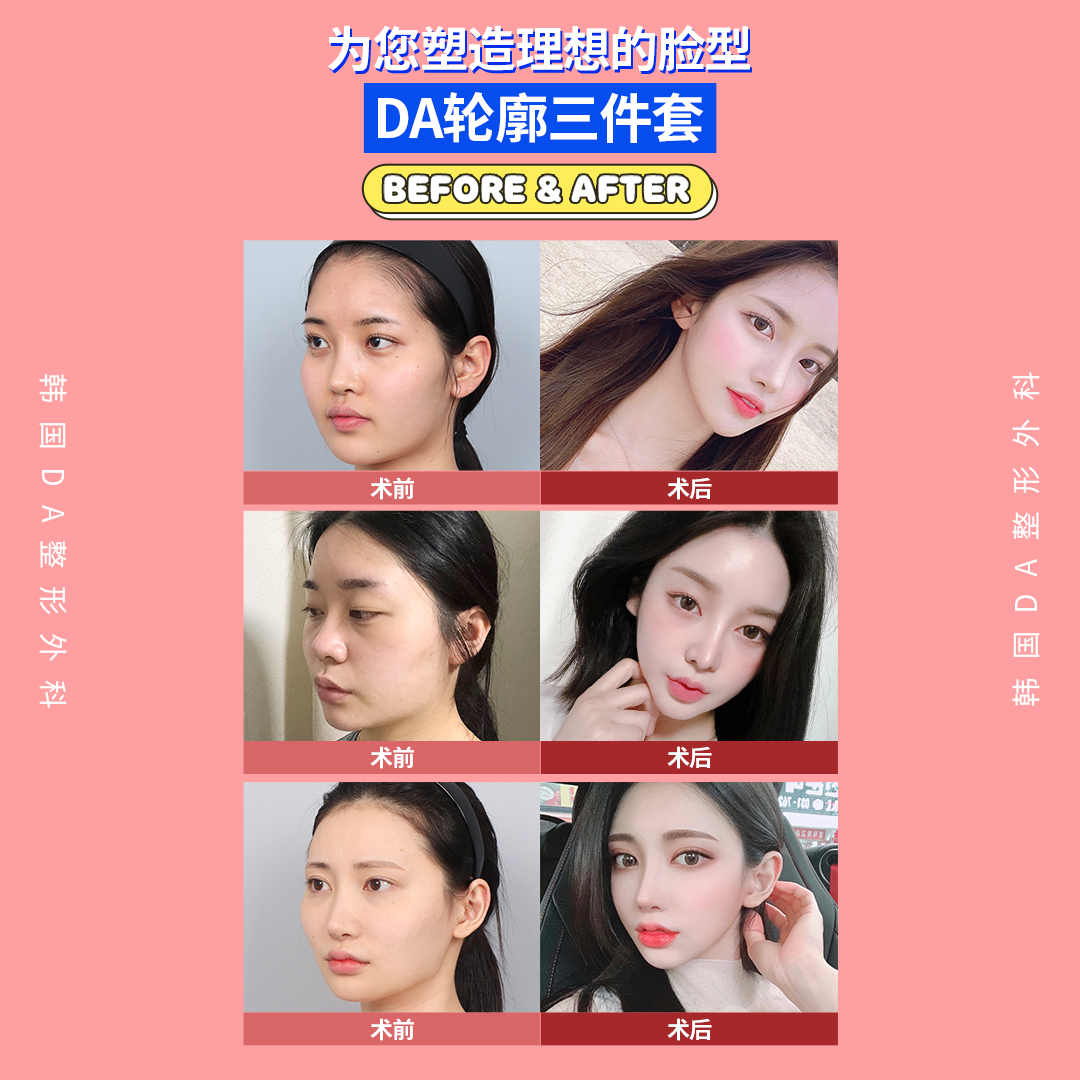 韓國da整形外科 Daprscn Twitter