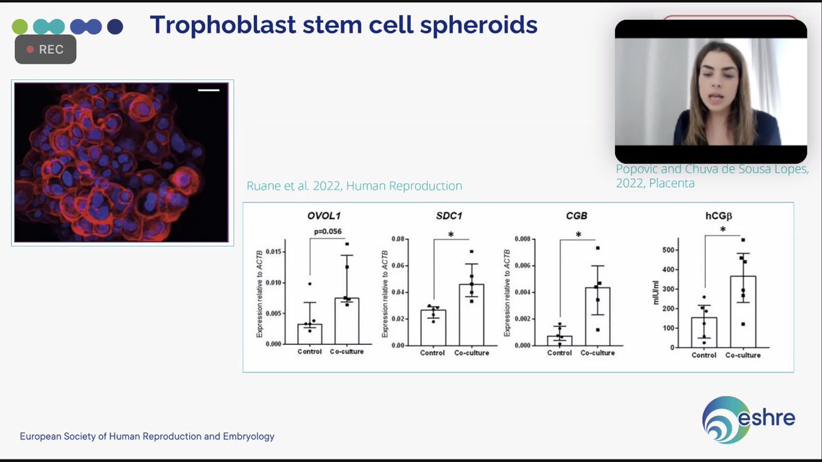 juanjo_fraire's tweet photo. Throphoblast stem cell spheroids will be discussed this Friday in our next #ESHREjc join us! ⁦@SigStemCells⁩ ⁦@mina_popovic_⁩ ⁦@ESHRE⁩ #ESHREssentials #ESHREjc https://t.co/UHGsfraJPk