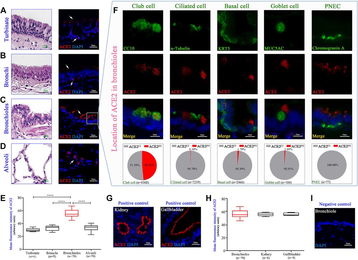 APSPublications's tweet photo. #Angiotensin-converting enzyme 2 in peripheral #lung club cells modulates the susceptibility to #SARSCoV2 in chronic obstructive pulmonary disease (Peng et al.) - new in @AJPLung
https://t.co/EAdznX7ojA
#ACE2 #COVID19 #COPD https://t.co/x8CyB5MGiA