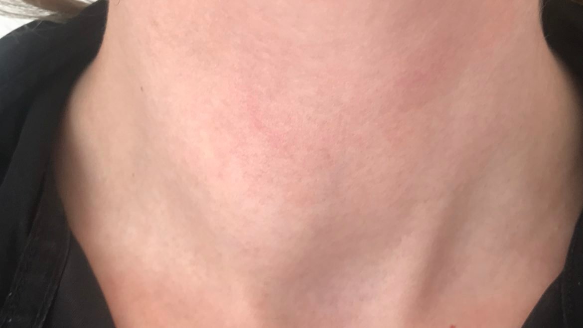 Richard Guttler MD,FACE,ECNU tweet media