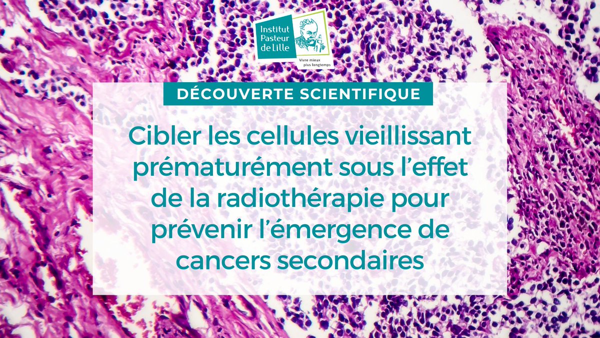 🔬 Les chercheurs @univ_lille, @CNRS_HdF, @PasteurLille, en collaboration avec le Centre Oscar Lambret, ont mis en évidence l’importance de cibler les cellules vieillissant prématurément sous l’effet de la radiothérapie pour #prévenir l’émergence de #cancers secondaires.