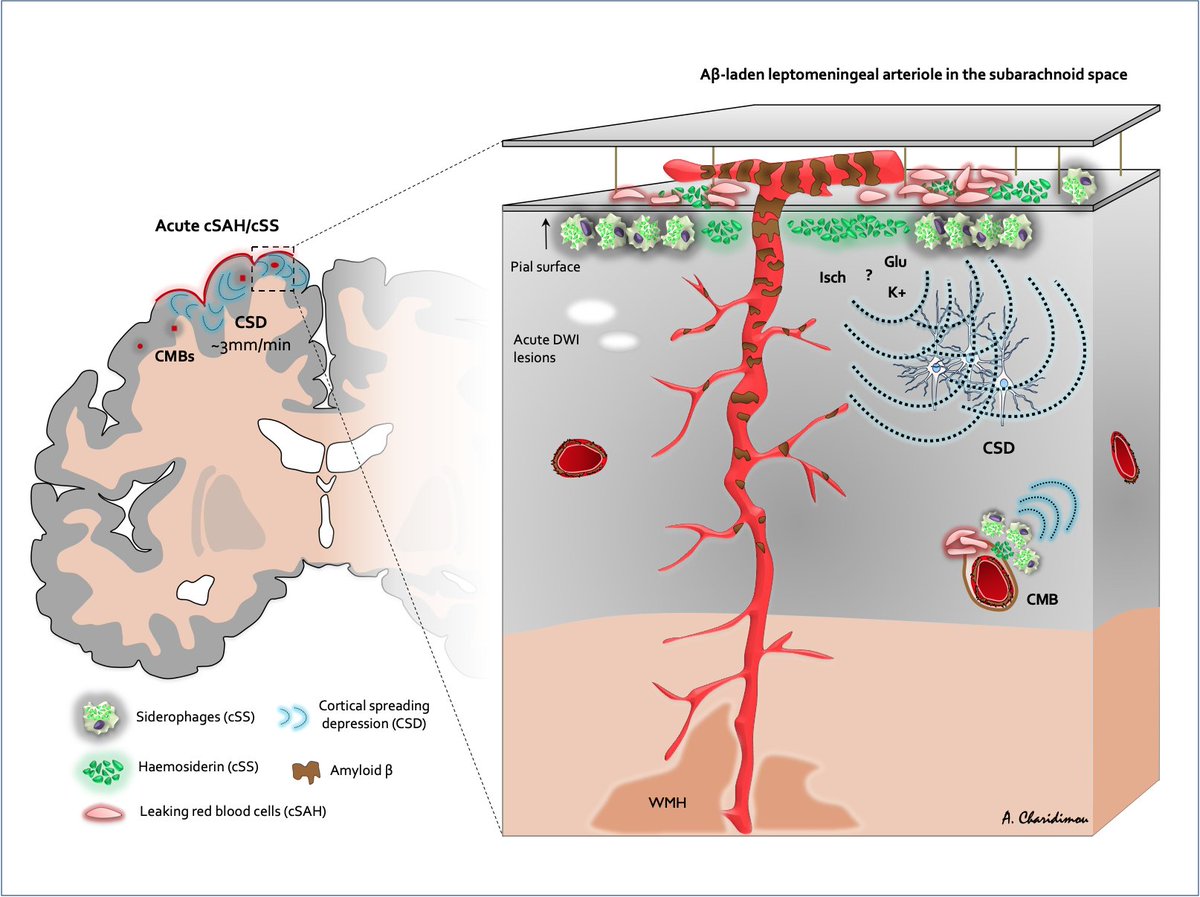 🧠🤿 Pathophysiology of amyloid spells in cerebral amyloid angiopathy (CAA)

[CAA-related transient focal neurological episodes]

#neurotwitter #MedEd #FOAMed #EndNeurophobia  #FOAMrad #radres #NeuroTwitter #NeuroRad #Neurology #RadEd #stroke #neurotwitternetwork #neuroscience