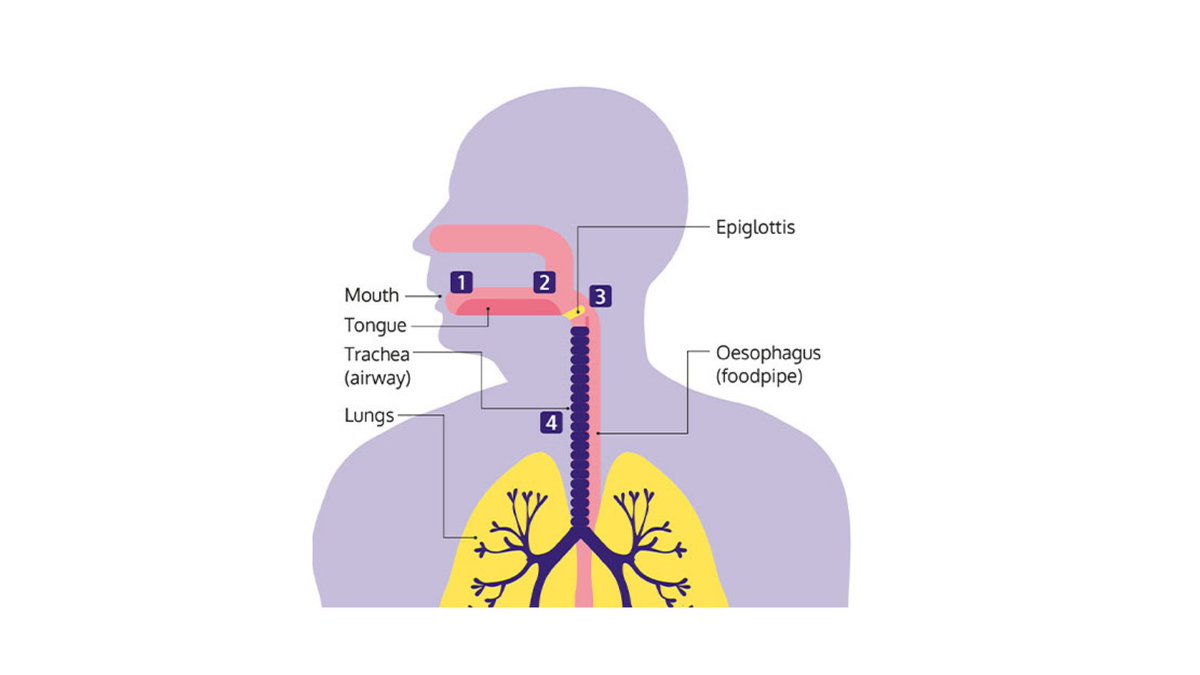 In tonight's #Emmerdale we saw Rhona save Marlon from choking. Swallowing problems are very common after a stroke. Almost half of people who have a stroke will have swallowing problems at first. Read more about the signs and tips to manage: bit.ly/3xBJjQJ