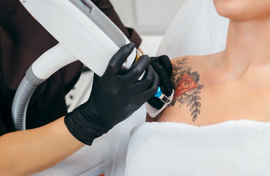 VanguardDermNY's tweet photo. Tattoos don't have to be forever! At Vanguard Dermatology, we offer laser tattoo removal treatment. This treatment lightens your unwanted ink, and in some cases, can even remove it completely. Contact us today to book your consultation. https://t.co/rmrncl9Ubu #tattooremoval https://t.co/ChtvMKA7v9