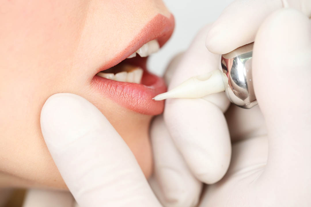 SuziSuzettee's tweet photo. We will safely and meticulously execute our lip blush procedure to make sure that your wishes are granted. We are perfectionists, and we take our time to cater to our client's needs. #LipBlush https://t.co/X2XWDFq5Ar https://t.co/Dx0LmxRjTl