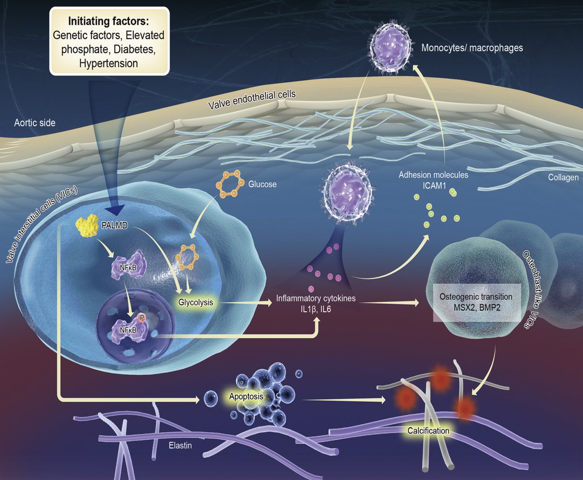 jbiolchem's tweet photo. "PALMD regulates aortic valve calcification via altered glycolysis and NF-κB-mediated inflammation"
Wang et al. propose that targeting PALMD-mediated glycolysis may represent a novel therapeutic strategy for treating #CAVD — #glycotime #PALMD
https://t.co/OXjEoZMEp7 https://t.co/eilXQYpTg9