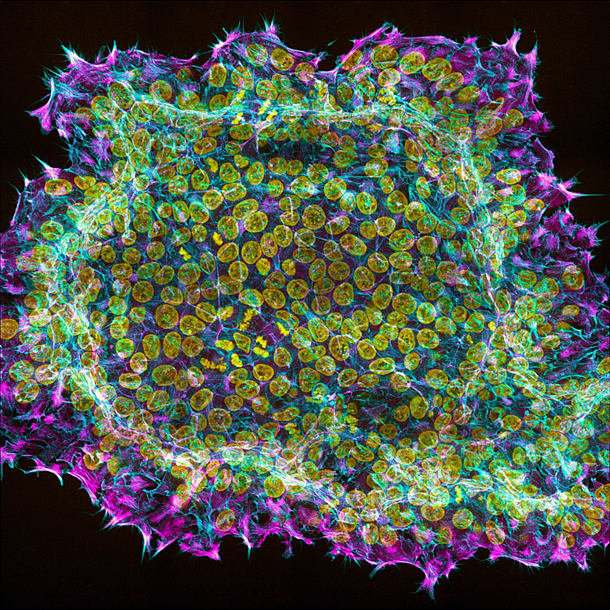 Dylan Burnette (@mag2art) on Twitter photo A colony of stem cells photographed through a microscope by <a href="/nilaytaneja/">Nilay Taneja</a>.
#Science #Nature #CellBiology #Art A colony of stem cells photographed through a microscope by <a href="/nilaytaneja/">Nilay Taneja</a>.
#Science #Nature #CellBiology #Art