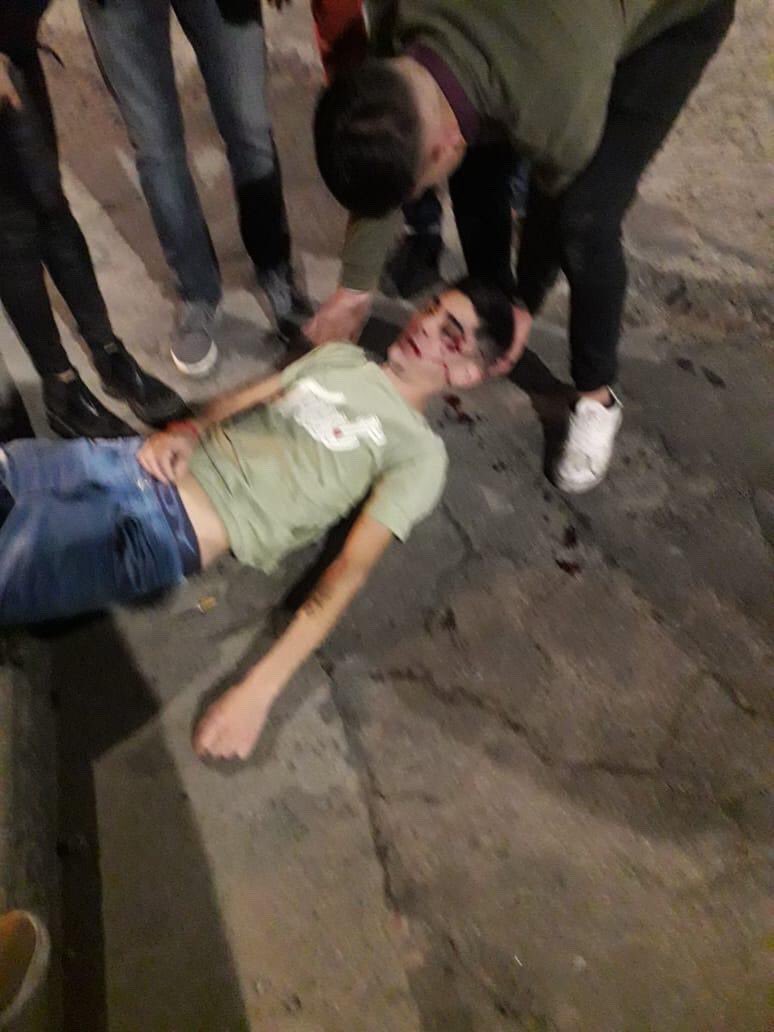 MicaVeelazquez's tweet photo. Hoy hace 20 días mi hermano Nicolas Velázquez fue agredido en la vía pública desde atrás con un objeto contundente, por un asesino llamado JORGE HORACIO PEREZ, más conocido como CORCHO PEREZ, que hace abandono de persona. https://t.co/jyHIkPHwtA