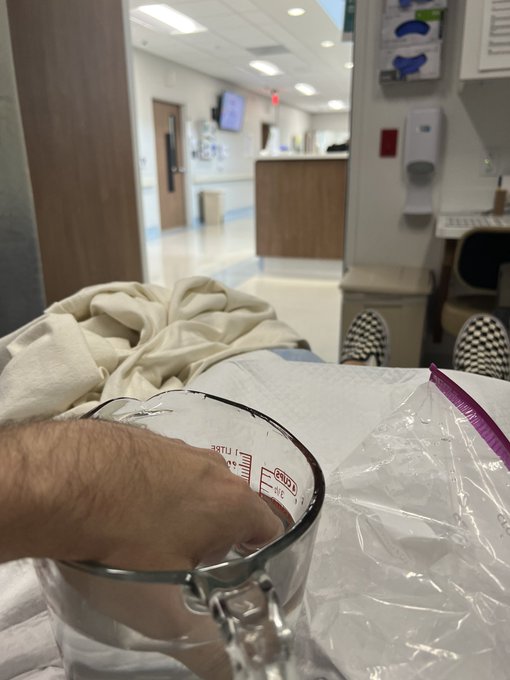 I stabbed my hand last month. Now I burned it. What should I do next https://t.co/svHqzipyrk<a href="/tag/onlyfans"class="tags"><span>#onlyfans</span></a>