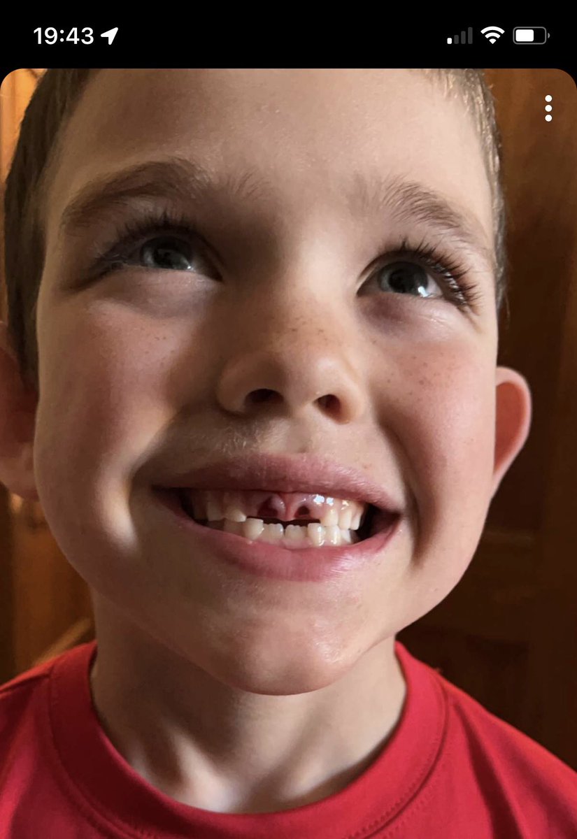 The tooth fairy is making BANK at our house. So far, four teeth gone thanks to a football. <a href="/Coach_Lueck/">Travis Lueck</a>