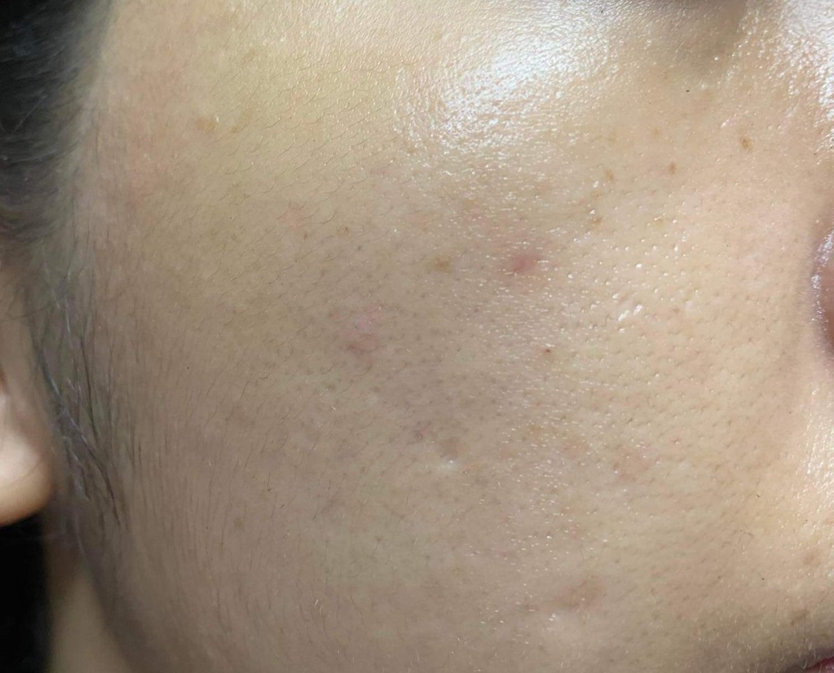 namkrnkmiinii's tweet image. MizuMi น้องซองชมพู น่ารักๆ น้องมี Advanced AHA ช่วยให้หน้ากระจ่างใส ผิวเรียบเนียน กับ BHA ที่ช่วยลดสิวต่างๆ ทาน้องครั้งแรกเนื้อเซรั่มซึมไวมาก บอกเลยเริศๆ ใช้ได้เช้าเย็นเลย มีขายในเซเว่นน้า ไปตำโล้ด😆 #รีวิวเซเว่น #ใช้ดีบอกต่อ