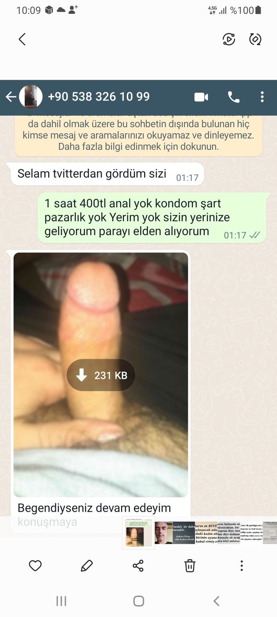 Böyle fotoğraf atarak kendinize alçaltmis oluyorsunuz terbiyessiz