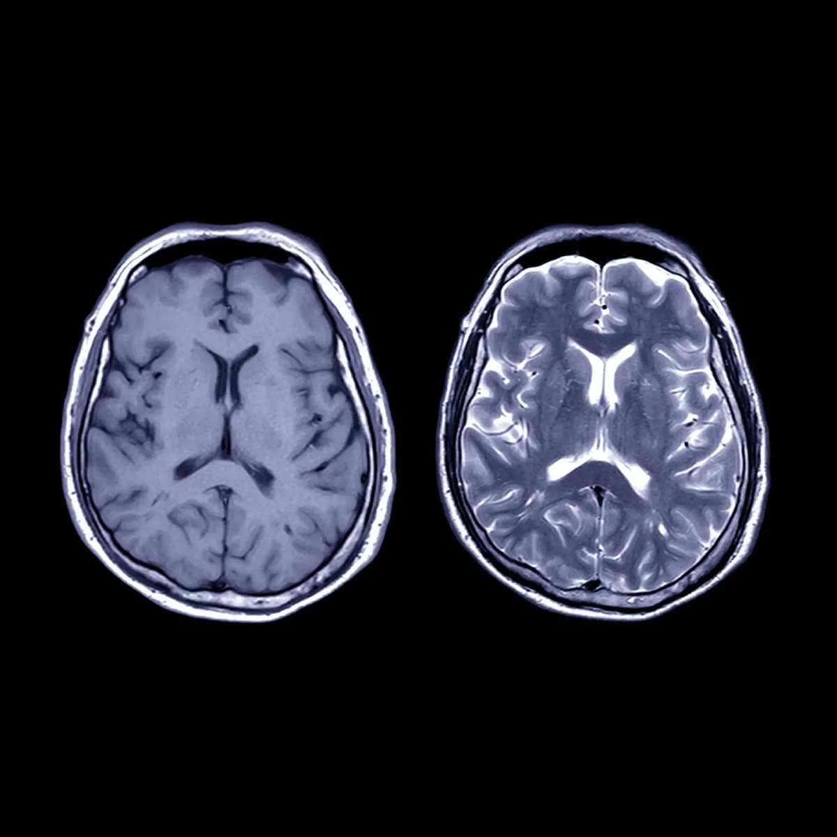 There are already digital twins of cities, ports, and power stations.

Now, Neurotwin is hoping the model can be used to predict the effects of stimulation for the treatment of neurological disorders, including epilepsy and Alzheimer’s disease.

wired.co.uk/article/the-qu…