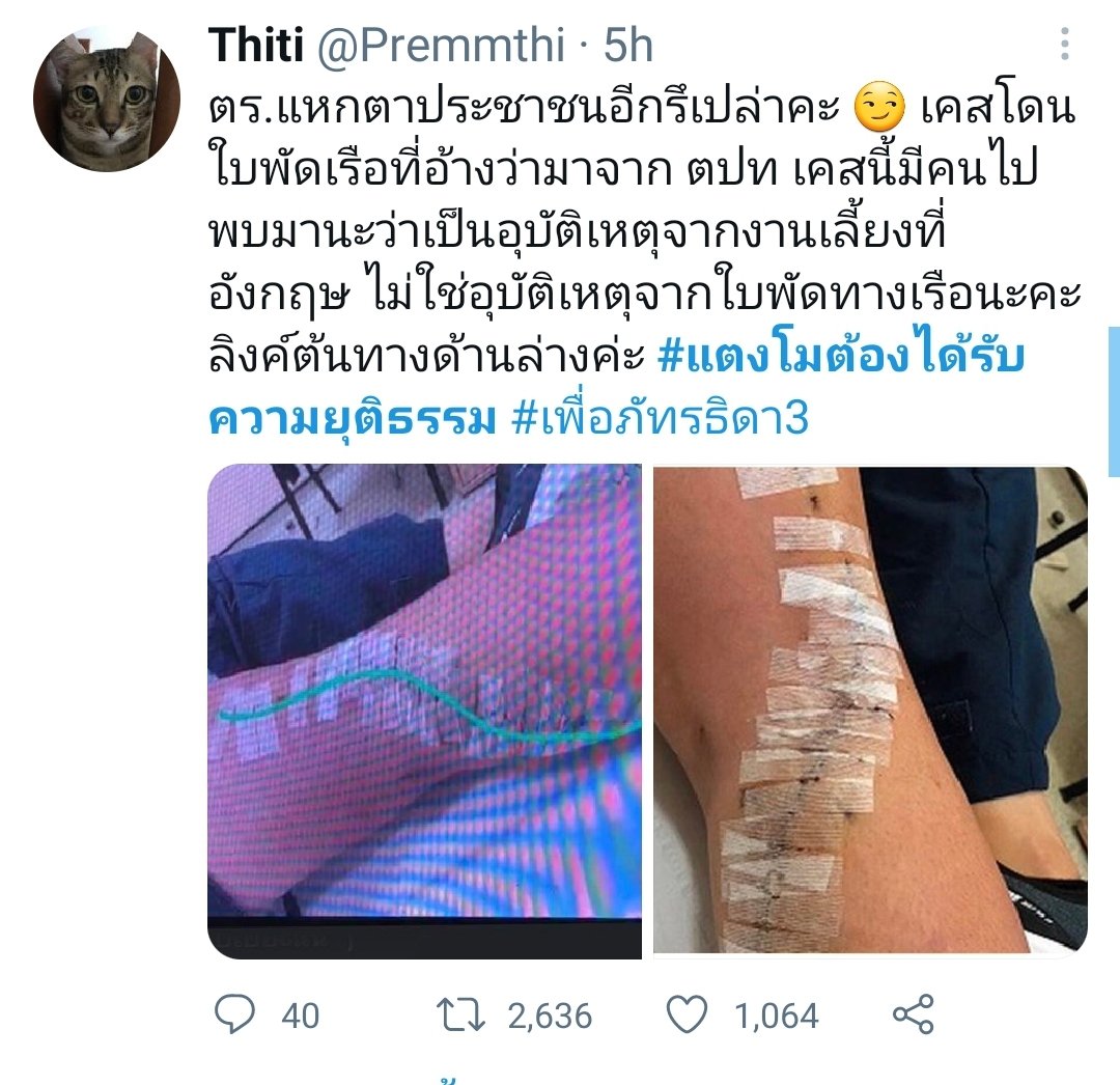 Sassy98023438's tweet photo. @pang_punn @201p__ มั่วนิ่ม แหกตาทุกเรื่อง  ยังไม่รวมแผลชาวอังกฤษ ทั้งเงาในคลิปกล้อง ไม่มีเงาหัวแต่บอกมีคน  งงว่าทำไมภาค1ช่างกล้า  สื่อออกทั่วโลก ขายขี้หน้าไปทั่วโลกเลยว่านี่คือศักยภาพตำรวจไทย
#แตงโมต้องได้รับความยุติธรรม
#เพื่อภัทรธิดา3 https://t.co/eVLjyuRCBl