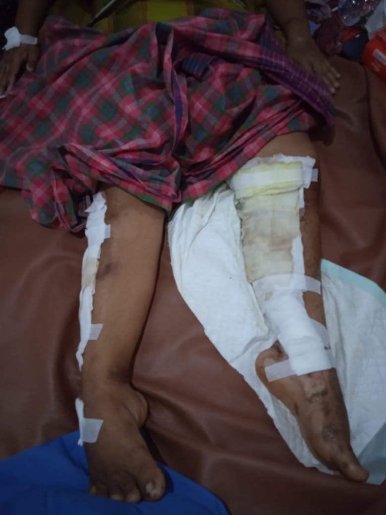 Acitttttz's tweet photo. Assalamu'alaikum,untuk semua orang baik di negeri ini, saya mau open donasi untuk keluarga tetangga saya an. M Taufik seorang tukang becak motor yang beralamat di desa Gempeng Kec Bangil Kab Pasuruan, pada tanggal 2 maret 2022 beliau sekeluarga terdiri dari M taufik, istri https://t.co/bff9nrmdvJ