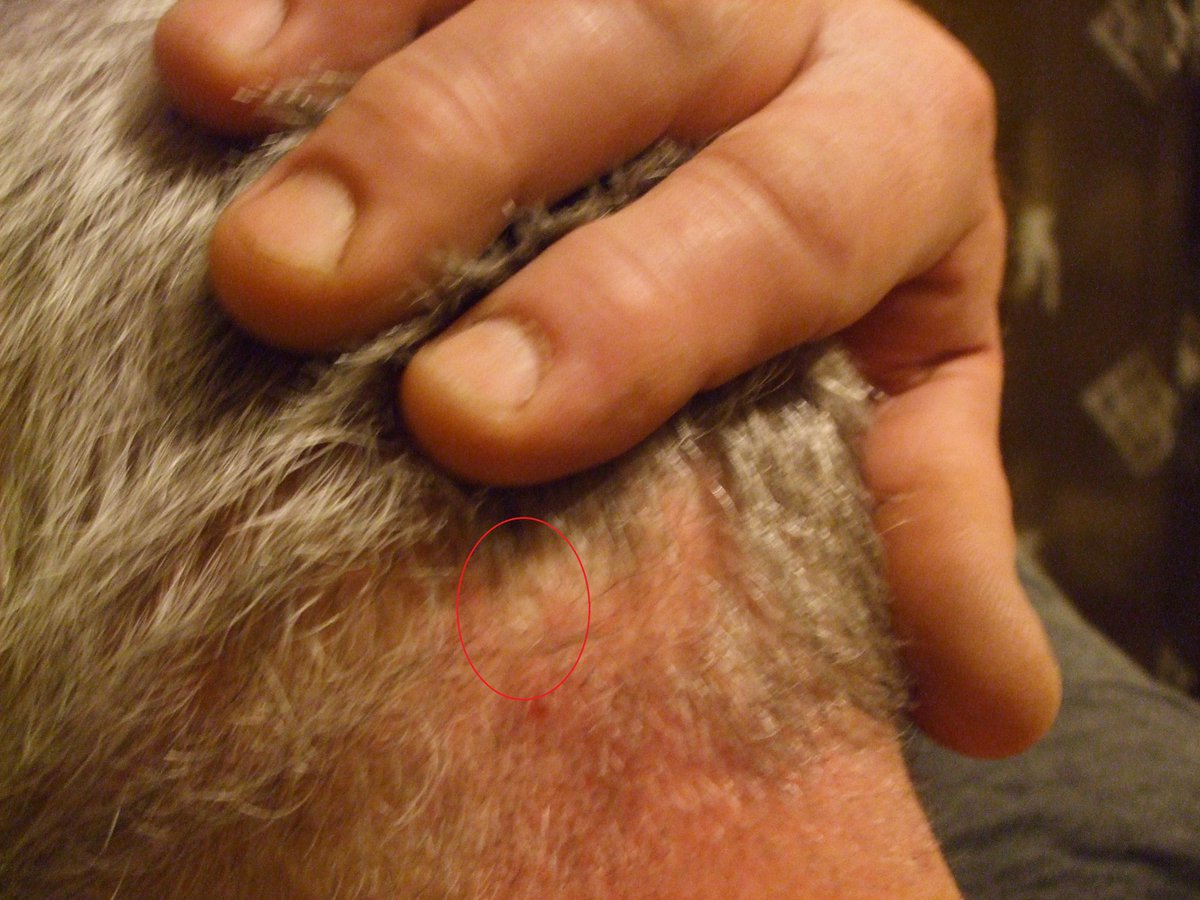 wheeloffreedom1's tweet photo. America will regret NOT passing new laws to prevent Non-Consent human RFID implants, "biometric sensors", #MedicalMicrochips. 
All the same!
#HumanRightsViolations #Nuremberg 
#HumanTrafficking 
#CyberTorture A.I. #RemoteNeuralMonitoring 
#NoTouchTorture 5G - Energy pulses/zaps https://t.co/57nzrxxHvC