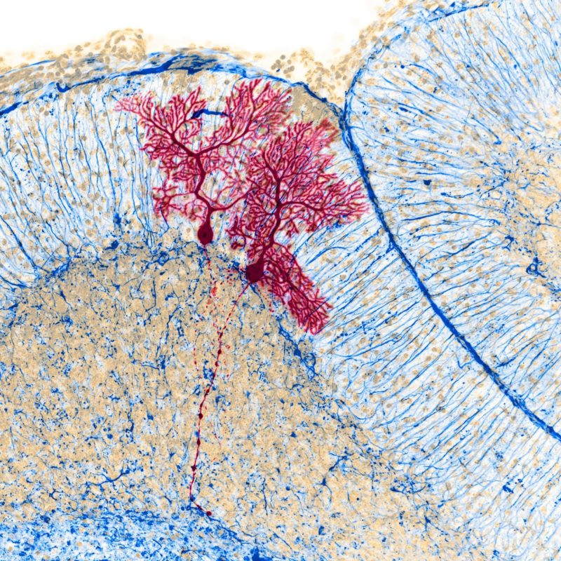 slava__bobrov's tweet photo. Two brain cells in the cerebellum shown using dye injection:

#neuroscience by B. Barti https://t.co/LNjeDc3uMV
