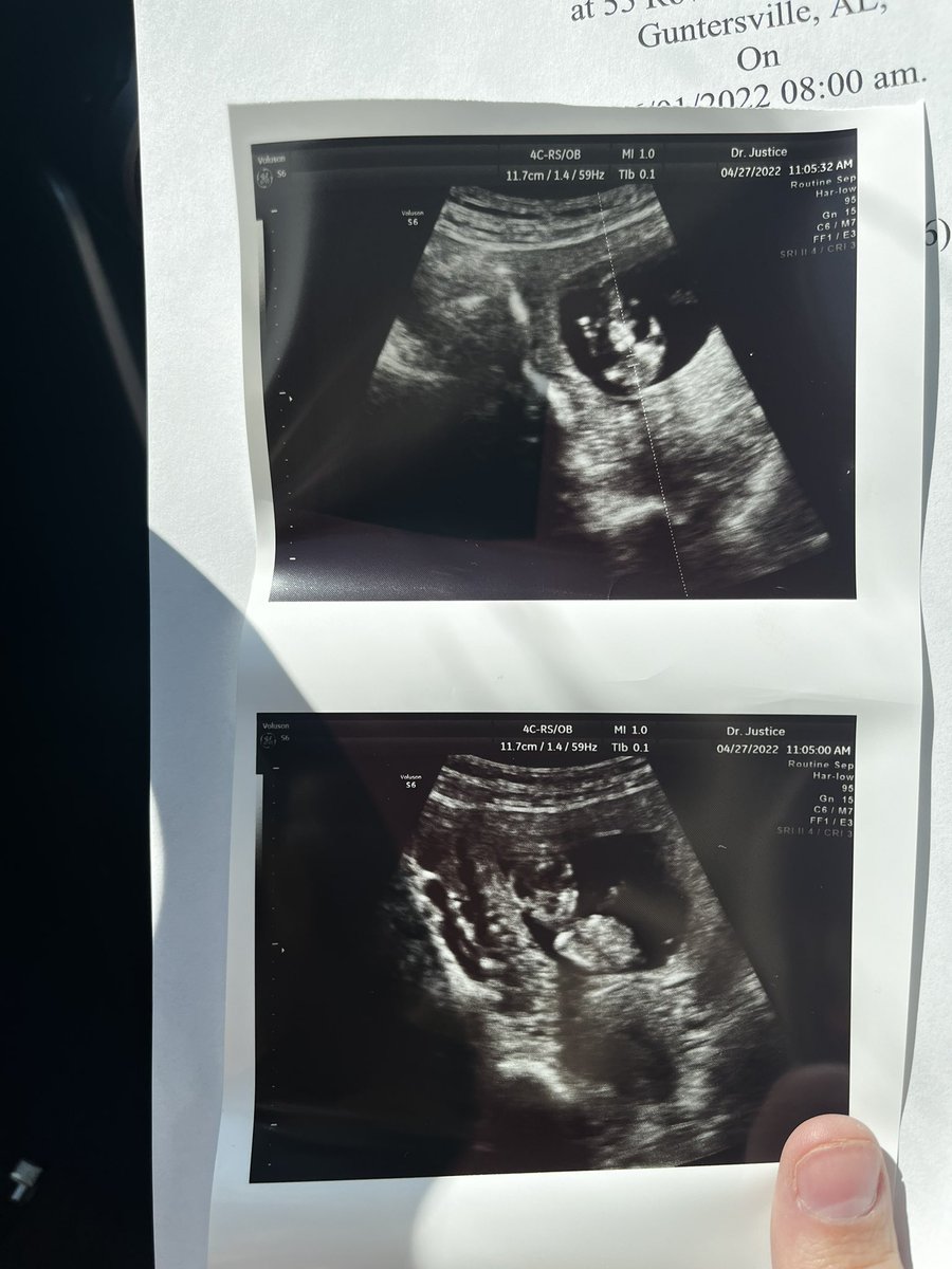 amanda_britany's tweet photo. little nugget 🥺😍 https://t.co/a4H0eZeqd3