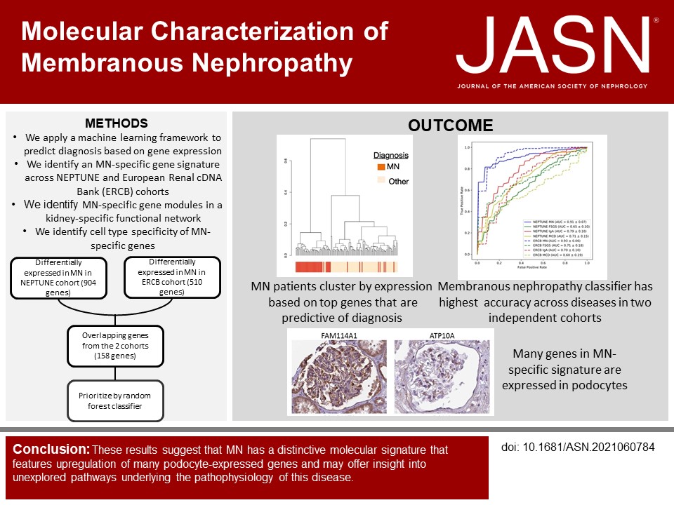 Membranous nephropathy (MN) commonly causes adult-onset nephrotic syndrome. This study found MN has a distinct molecular signature, including increased expression of many podocyte-expressed genes, that distinguishes it from other glomerulonephropathies bit.ly/j2021060784