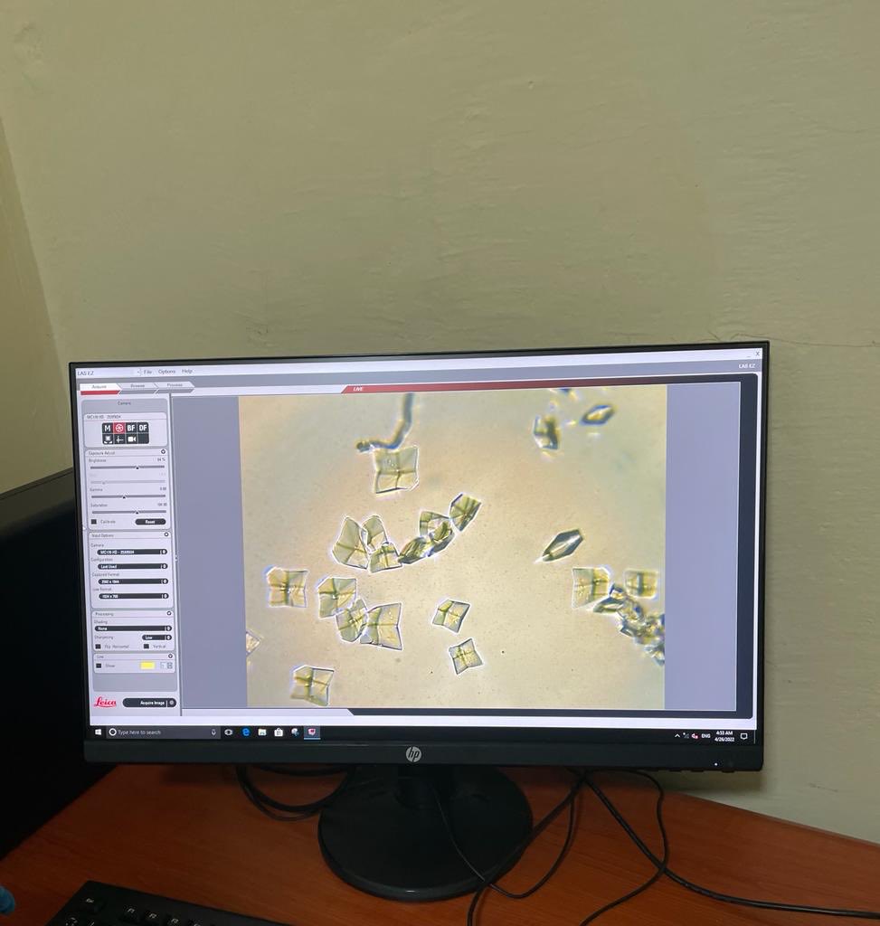 Crystals grown by vapor diffusion &amp; X-ray/Cro-EM data collected remotely <a href="/ESRF/">Andrew</a> ⁦<a href="/BiostructA/">BioStruct-Africa</a>⁩ course in Bamako! 👩🏾‍🎓African female scientists on the charge 💪🏾💪🏾💪🏾 Thanks to Company of Biologists, @Royal Society of Chemistry, ⁦<a href="/IUCr/">IUCr</a>⁩, ⁦<a href="/MrtcParasito/">PMRTC</a>⁩ #YesSheCan