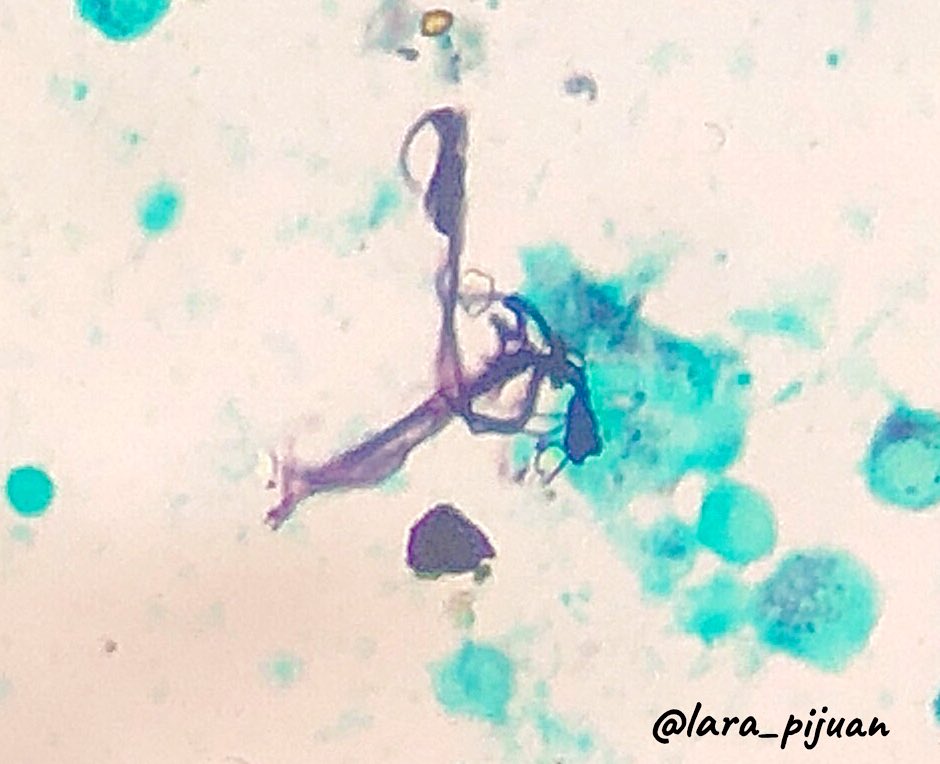 lara_pijuan's tweet photo. @GianniIppolitii My favorites one are hearts but you can find everything if you open mind ๐
@GianniIppolitii as you like music, can you guess this one ๐?
#pathreidolia #pathart https://t.co/MXK9gPPjKV
