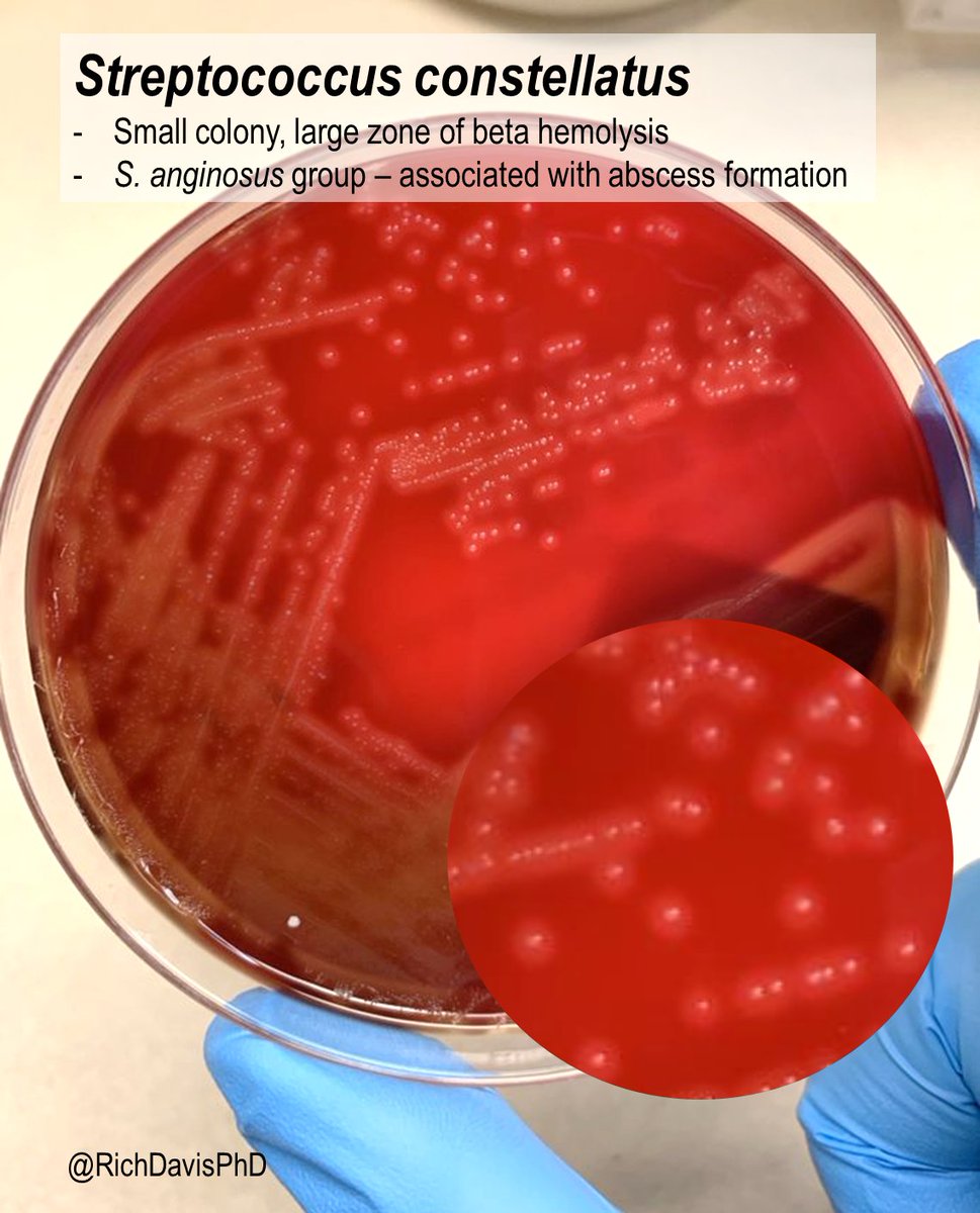 #MicroRounds (Day 925): 'constellation of stars…'

A nearly pure culture of Streptococcus constellatus, with small colonies & large zones of beta hemolysis, looks like a field of stars.

S. anginosus group are associated w/ abscess formation #ASMClinMicro #IDTwitter #LabWeek2022