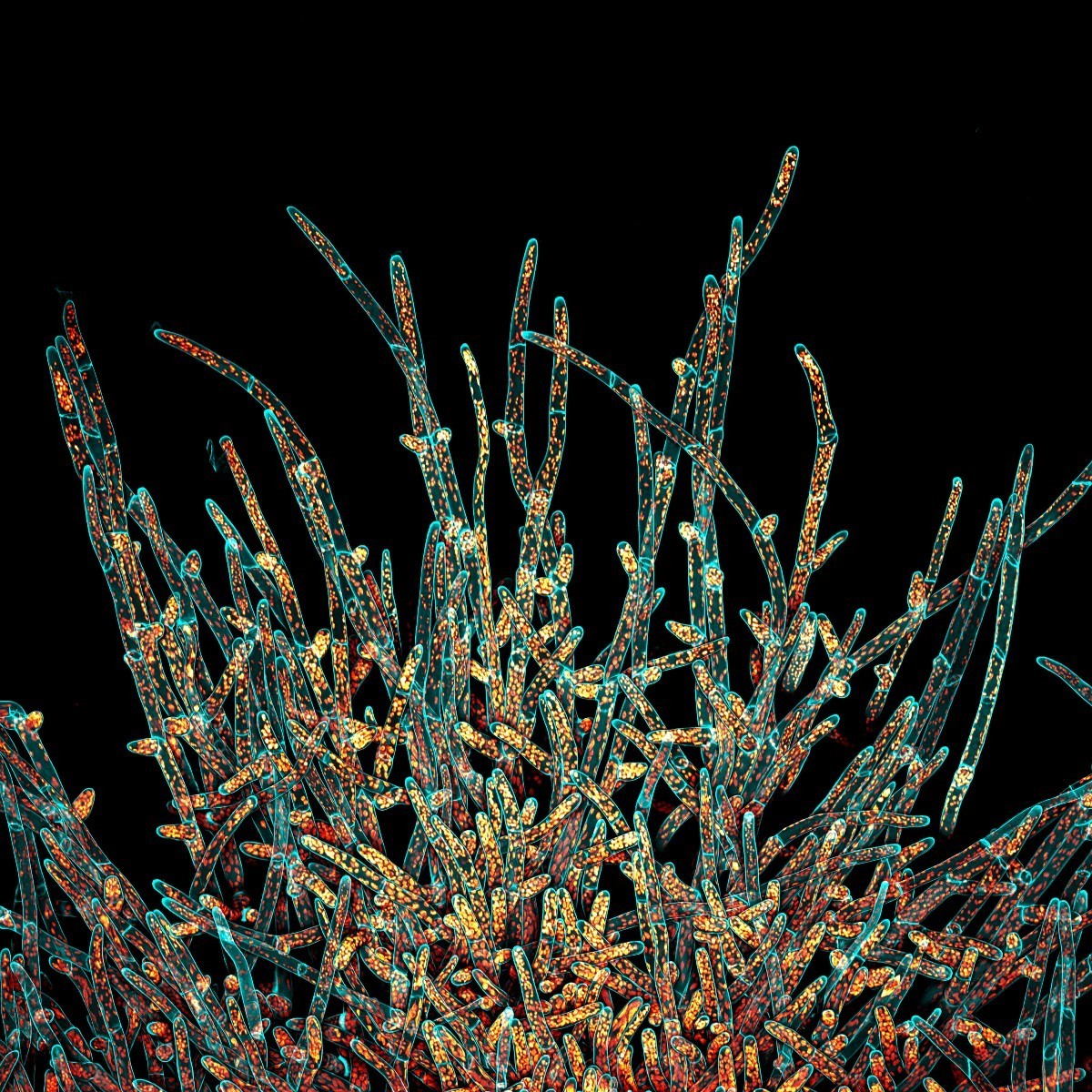 Evident_LS's tweet photo. This image of Physcomitrium patens (a type of moss) took the Image of the Year title for the Americas!
Congratulations to Ivan Radin from the USA!
For more information on this year's winners, head to - https://t.co/pY02e1TwKF
#ImageoftheYear https://t.co/Z9Jb940LYw