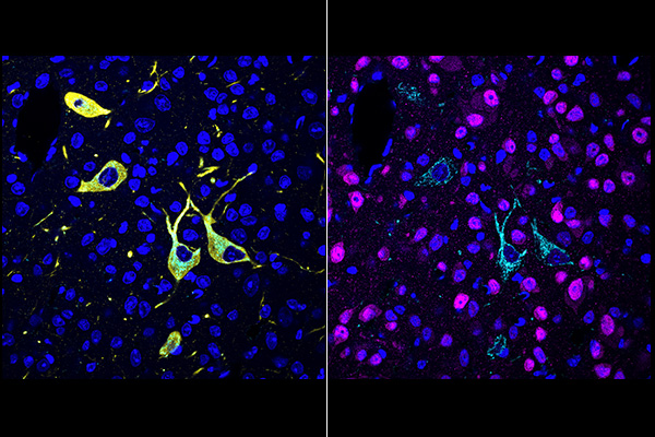 scrippsresearch's tweet photo. The labs of @liye_tsri and Ben Cravatt have made the impossible possible – developing a new method called CATCH, which allows the imaging of specific drugs in tissue to reveal where the compounds are acting in the body https://t.co/Ked5NC9JMa @CellCellPress https://t.co/xdDRGGH2qo