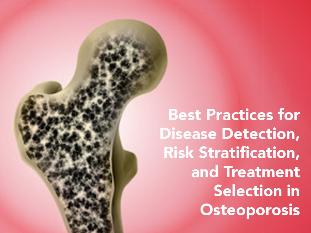 RealCME's tweet image. This 15-minute, case-based CME activity, developed by experts, will discuss evidence-based approaches to screening, diagnosing, and treating osteoporosis

realcme.com/learner/course…

#cmechat #cme #MedEd #Osteoporosis #MedicalEducation