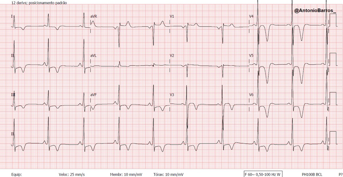 Antonio Carlos Leite de Barros Filho tweet media