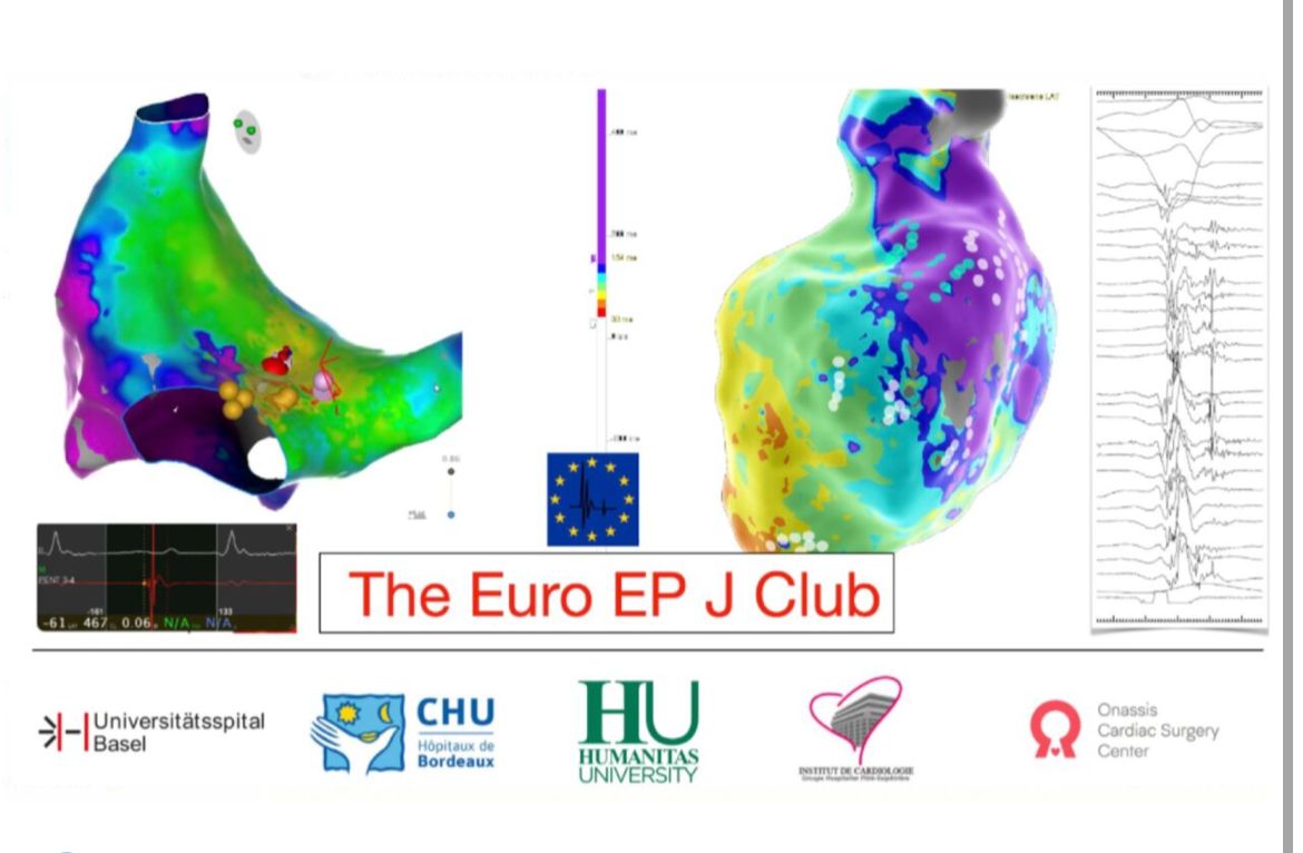 Tomorrow at 5.15 PM (CET) I will be talking at the Euro J Club. The topic is the functional phenomena occurring in the atria in patients with atrial fibrillation. What's electrical remodeling? Feel free to join. bit.ly/39fUDdj