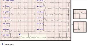 SportsCardiology tweet media