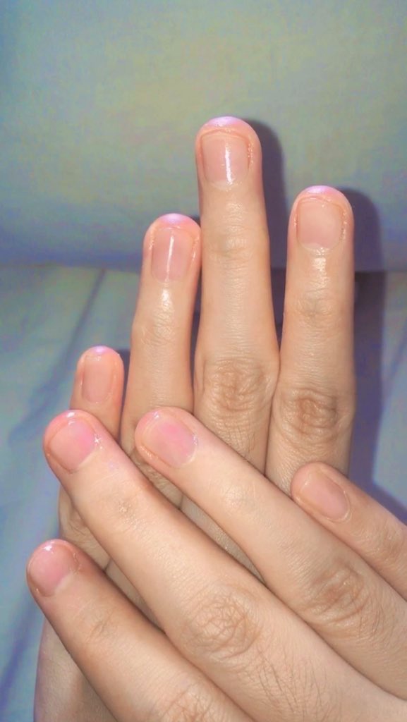 secretlyfura's tweet photo. Lelaki &amp; perempuan that suffers from kuku kering &amp; banyak cuticle pedih tu, dont scroll away this tweet. 

I sebelumni suffers from the same problem but okay dah <3 So I nak share :

Two products you need to get that healthy &amp; cuticle-free nails, lets goooo👇🏻🦋 https://t.co/iYm1DHhcUK