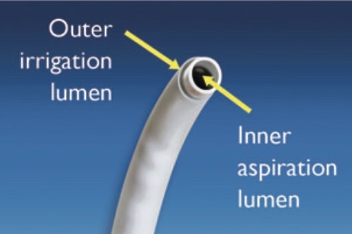 CVAC - steerable stone aspiration device - shows promising results for increased removal of stone fragments during ureteroscop <a href="/DrMaheshDesai4/">Dr Mahesh Desai</a> <a href="/PurplePMan/">Glenn Preminger, M.D.</a> <a href="/BEkidneystone/">Brian Eisner</a> <a href="/GeorgeHaleblian/">George Haleblian</a> <a href="/UCSD_Urology/">UCSD Urology</a> <a href="/DukeUrology/">Duke Urology</a> <a href="/BWHUrology/">Brigham and Women's Hospital Department of Urology</a> DOI: 10.1089/end.2021.0759