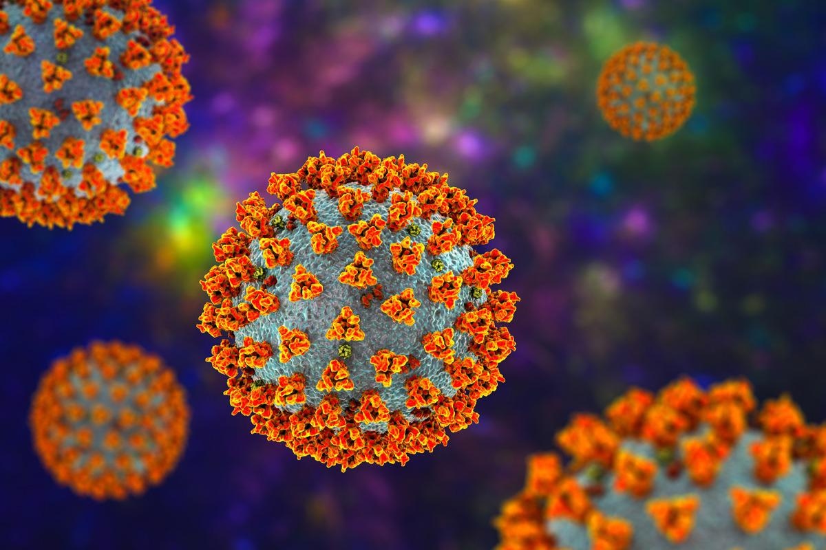 NewsMedical's tweet photo. Potential indirect and direct effects of SARS-CoV-2 on pancreatic islets in patients who became hyperglycemic after COVID-19 https://t.co/s31qELLA3t @ADA_Pubs @harvardmed @LaStatale #SARSCoV2 #COVID19 #coronavirus #covid #hyperglycemic #pancreas https://t.co/pf51VnDkoa