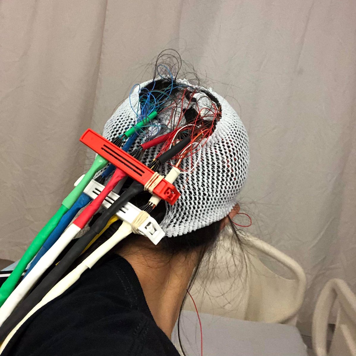 She was thrilled when the Montreal Neuro asked her to participate in a research study. « I’m a rare case, Mommy. I can help other people with epilepsy. » Selfless, fearless and strong. #epilepsy #brainhealth