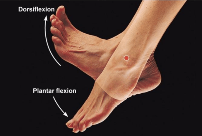 2002Mertcelik's tweet photo. 3. Examination of DVT
-Positive Homans's Sign
- Calf pain at dorsiflexion of the of foot.
- Wells Score - more than or equal to 2 suggests DVT. https://t.co/LBJOpPoOqY